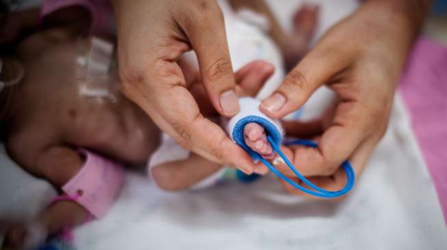 Bayi Prematur Berisiko Stunting, Ini yang Perlu Dilakukan Untuk Mengejar Pertumbuhannya Sebelum Terlambat, Deempatbelas.com