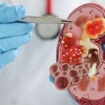 KEMENKES KELUARKAN EDARAN BARU SOAL KASUS GAGAL GINJAL AKUT, MINTA DINKES PANTAU PENGGUNAAN OBAT SIRUP