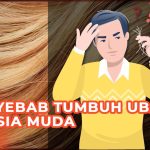 MUNCUL UBAN PADAHAL MASIH MUDA? BERIKUT PENYEBAB SERTA CARA MENGATASINYA