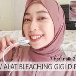 7 TIPS MUDAH MEMUTIHKAN GIGI SECARA ALAMI DI RUMAH