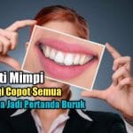 9 ARTI MIMPI GIGI COPOT SEMUA YANG DIANGGAP BURUK