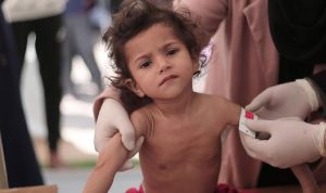 Jalur Gaza Diblokade, 66 Anak Palestina Tewas akibat Malnutrisi, Deempatbelas.com