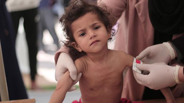 Jalur Gaza Diblokade, 66 Anak Palestina Tewas akibat Malnutrisi, Deempatbelas.com
