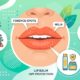 5 CARA AMPUH MENGATASI BINTIK PUTIH DI BIBIR SECARA ALAMI