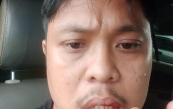 DIDUGA DIANIAYA “ANAK MAIN” ANGGOTA DEWAN DI KANTOR CAMAT LUBUK PAKAM, ADE PITRIAN LAPOR POLISI