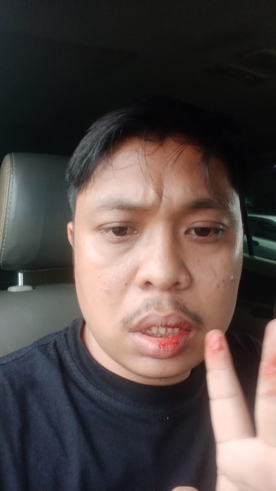 DIDUGA DIANIAYA "ANAK MAIN" ANGGOTA DEWAN DI KANTOR CAMAT LUBUK PAKAM, ADE PITRIAN LAPOR POLISI DIDUGA DIANIAYA "ANAK MAIN" ANGGOTA DEWAN DI KANTOR CAMAT LUBUK PAKAM, ADE PITRIAN LAPOR POLISI